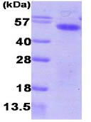 15% SDS-PAGE showing ab86846 at approximately 47.9kDa (3µg).