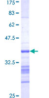 ab160382 on a 12.5% SDS-PAGE stained with Coomassie Blue.