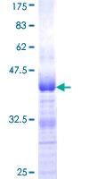 ab161885 on a 12.5% SDS-PAGE stained with Coomassie Blue.