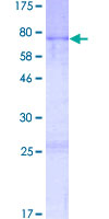 ab163479 on a 12.5% SDS-PAGE stained with Coomassie Blue.