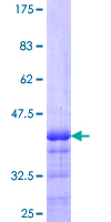 ab163481 on a 12.5% SDS-PAGE stained with Coomassie Blue.