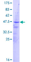 ab163711 on a 12.5% SDS-PAGE stained with Coomassie Blue.