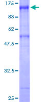 ab163854 on a 12.5% SDS-PAGE stained with Coomassie Blue.