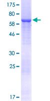 ab163822 on a 12.5% SDS-PAGE stained with Coomassie Blue.
