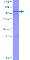 ab160150 on a 12.5% SDS-PAGE stained with Coomassie Blue.
