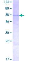 ab160153 on a 12.5% SDS-PAGE stained with Coomassie Blue.