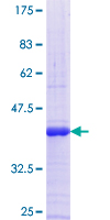 ab160154 on a 12.5% SDS-PAGE stained with Coomassie Blue.