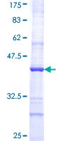 ab160152 on a 12.5% SDS-PAGE stained with Coomassie Blue.