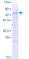 ab160148 on a 12.5% SDS-PAGE stained with Coomassie Blue.