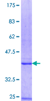 ab160149 on a 12.5% SDS-PAGE stained with Coomassie Blue.