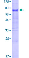 ab165517 on a 12.5% SDS-PAGE stained with Coomassie Blue.