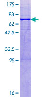 ab161932 on a 12.5% SDS-PAGE stained with Coomassie Blue.
