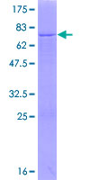 ab161261 on a 12.5% SDS-PAGE stained with Coomassie Blue.
