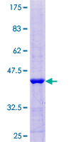 ab161262 on a 12.5% SDS-PAGE stained with Coomassie Blue.