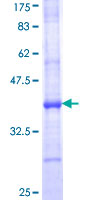 ab161108 on a 12.5% SDS-PAGE stained with Coomassie Blue.