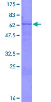 ab160950 on a 12.5% SDS-PAGE stained with Coomassie Blue.