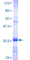 ab160951 on a 12.5% SDS-PAGE stained with Coomassie Blue.