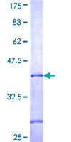 ab164023 on a 12.5% SDS-PAGE stained with Coomassie Blue.
