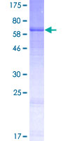 ab164930 on a 12.5% SDS-PAGE stained with Coomassie Blue.