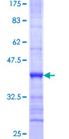 ab158491 on a 12.5% SDS-PAGE stained with Coomassie Blue.