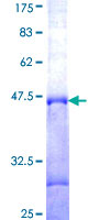 ab158515 on a 12.5% SDS-PAGE stained with Coomassie Blue.