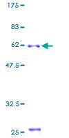 ab160147 on a 12.5% SDS-PAGE stained with Coomassie Blue.