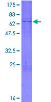 ab160146 on a 12.5% SDS-PAGE stained with Coomassie Blue.