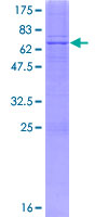 ab161405 on a 12.5% SDS-PAGE stained with Coomassie Blue.