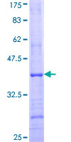 ab161406 on a 12.5% SDS-PAGE stained with Coomassie Blue.
