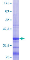 ab161407 on a 12.5% SDS-PAGE stained with Coomassie Blue.
