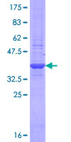 ab164273 on a 12.5% SDS-PAGE stained with Coomassie Blue.