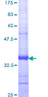 ab153246 on a 12.5% SDS-PAGE stained with Coomassie Blue.