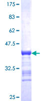 ab153475 on a 12.5% SDS-PAGE stained with Coomassie Blue.