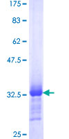 ab159547 on a 12.5% SDS-PAGE stained with Coomassie Blue.