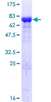 ab160533 on a 12.5% SDS-PAGE stained with Coomassie Blue.