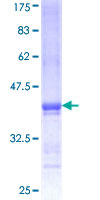 ab157952 on a 12.5% SDS-PAGE stained with Coomassie Blue.