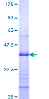 ab157953 on a 12.5% SDS-PAGE stained with Coomassie Blue.