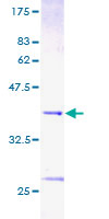 ab152917 on a 12.5% SDS-PAGE stained with Coomassie Blue.
