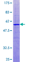 ab163290 on a 12.5% SDS-PAGE stained with Coomassie Blue.