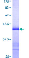 ab163291 on a 12.5% SDS-PAGE stained with Coomassie Blue.