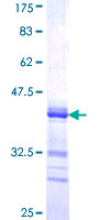 ab166307 on a 12.5% SDS-PAGE stained with Coomassie Blue.