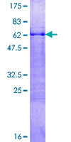 ab163399 on a 12.5% SDS-PAGE stained with Coomassie Blue.