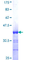 ab163400 on a 12.5% SDS-PAGE stained with Coomassie Blue.