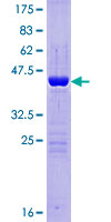 ab163164 on a 12.5% SDS-PAGE stained with Coomassie Blue.