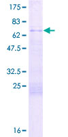 ab159910 on a 12.5% SDS-PAGE stained with Coomassie Blue.