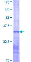 ab159911 on a 12.5% SDS-PAGE stained with Coomassie Blue.