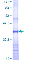 ab159913 on a 12.5% SDS-PAGE stained with Coomassie Blue.