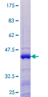 ab163105 on a 12.5% SDS-PAGE stained with Coomassie Blue.