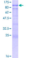 ab162305 on a 12.5% SDS-PAGE stained with Coomassie Blue.