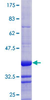 ab162306 on a 12.5% SDS-PAGE stained with Coomassie Blue.